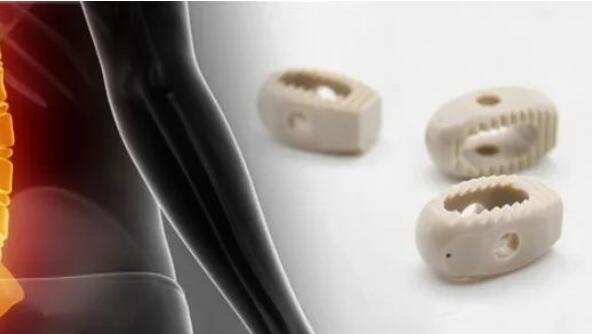 What is the difficulty in replacing domestic imports of domestic medical implantable PEEK?